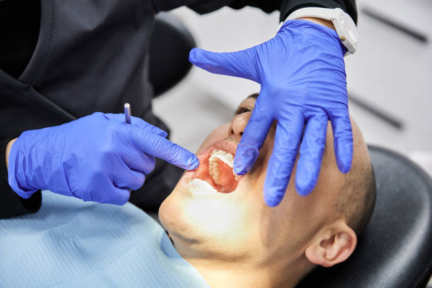 Best Emergency Root Canal Treatment in Yacolt, WA
