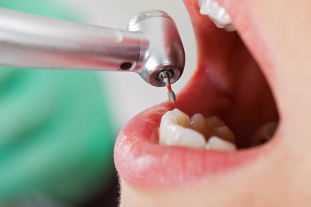 Best Cosmetic Emergency Dentistry in Yacolt, WA
